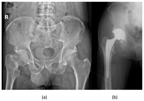 Biomedicines | Special Issue : Advanced Research on Muscle and Bone ...