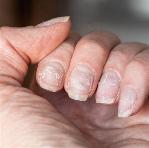 stop gel nails peeling