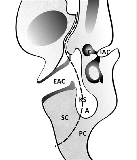 Process Bone 的图像结果