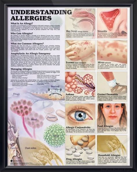 Infant Age & Allergies: Understanding & Managing
