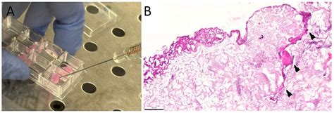 Collagen-Based 3D Scaffolds from Sea Urchin Food Waste for Skeletal ...