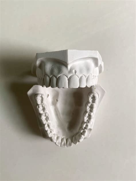 Image result for How to Take Study Models with Plaster Lab