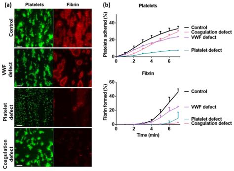 Whole Blood Based Multiparameter Assessment of Thrombus Formation in ...