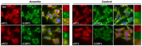 Relocalization of Translation Termination and Ribosome Recycling ...