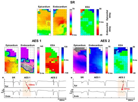 JCM | Special Issue : New Approaches to the Atrial Fibrillation Management