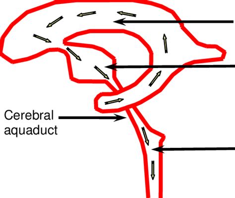 CSF Ventricular System 的图像结果