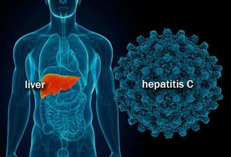 2,000 Hepatitis C Cases Emerge In UP's Shamli District, Locals Blame ...