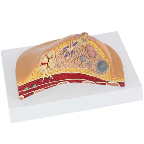 Buy Woman Anatomy Anatomy Template Shows Lobular Lobular Hyperplasia ...