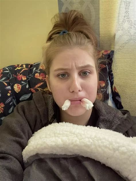 All 4 wisdom teeth pulled, still very numb but home. Hopefully quick recovery and hopefully not ...