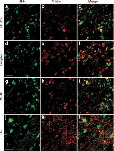 Image result for Intrathecal Injection Mouse