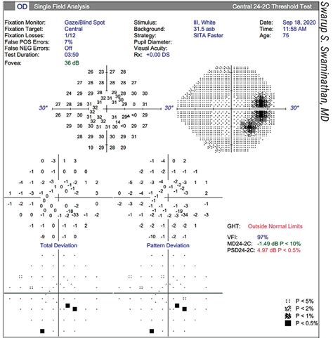 Image result for Peripheral Vision Test Results