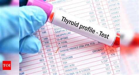 Thyroid function test: Know what T3, T4 and TSH mean - Times of India