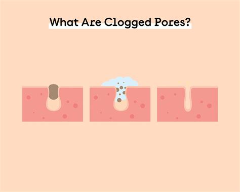 3 Simple Ways To Clear Out Pores – Quench Botanics