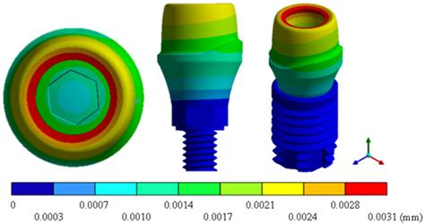 Materials | Special Issue : Dental Implants and Materials (Second Volume)