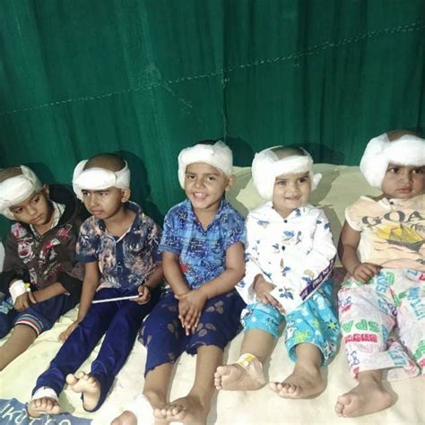 Cochlear Implant: બાળક જન્મજાત બોલવા/સાંભળવામાં અક્ષમ હોય તો ગભરાશો ...