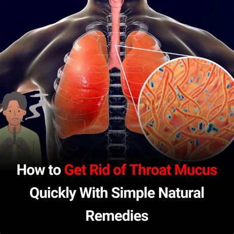 Get Rid of Throat Mucus Faster: Science-Backed Home Treatments