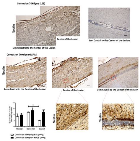 Cells | Special Issue : Stem Cells and Degenerative Diseases