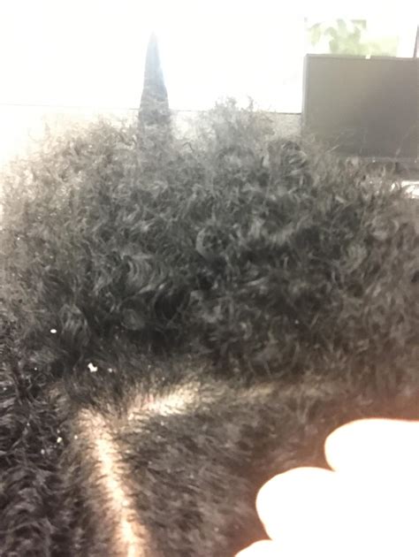How do you tell the difference between dry scalp flakes and build up flakes? Can't figure out ...