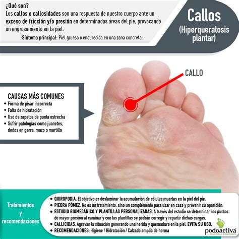 Callos en los pies o callosidades. Qué son, cómo tratarlos y cómo ...