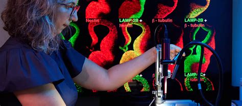 Montefiore Einstein Neurology Research