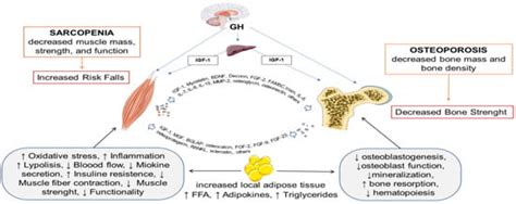 Osteosarcopenia: A Narrative Review on Clinical Studies