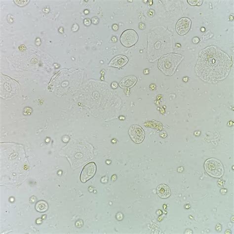 Image result for Transitional Epithelial Cells