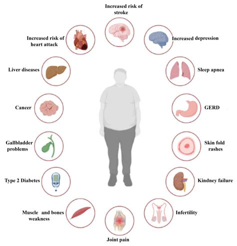 Emerging Role of GLP-1 Agonists in Obesity: A Comprehensive Review of Randomised Controlled Trials