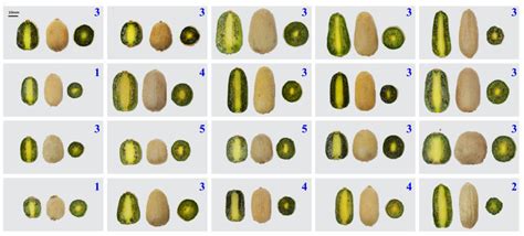 Genome-Wide Association Studies Provide Molecular Insights into the ...