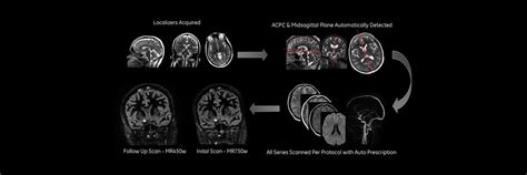 READYBrain | GE HealthCare (India)