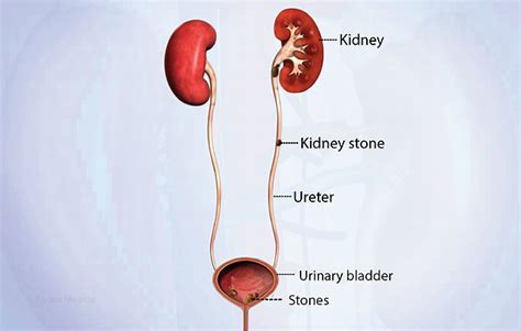 Health Condition : Symptoms, Causes, Treatment and More