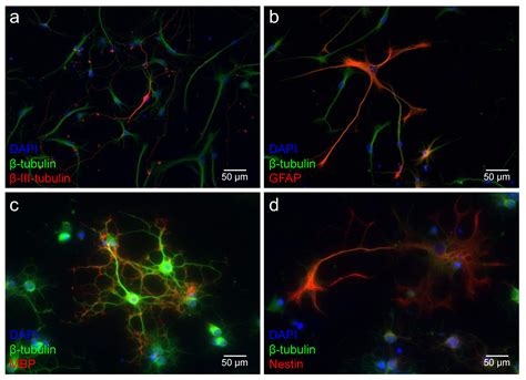 Adult Neurogenesis of the Medial Geniculate Body: In Vitro and ...