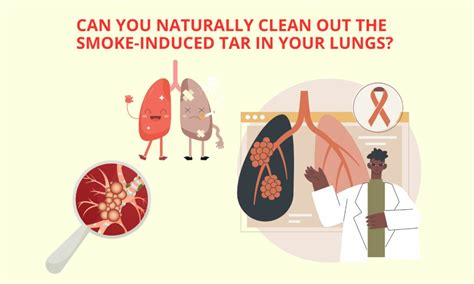 Brown Specks in Phlegm After Quitting Smoking [Full Guide]