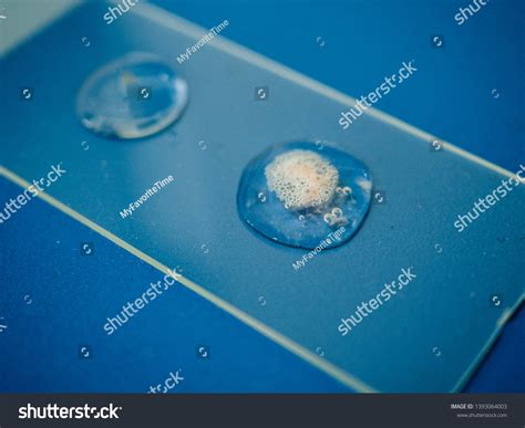 220 Catalase Images, Stock Photos & Vectors | Shutterstock