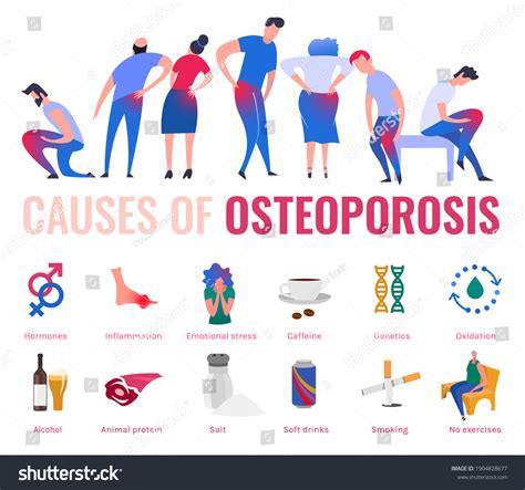 Causes Osteoporosis Bone Loss Medical Infographic Stock Illustration 1904828677 | Shutterstock