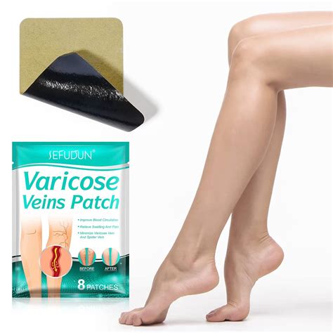 Varicose Veins Treatment for Legs,Soothing Leg India | Ubuy