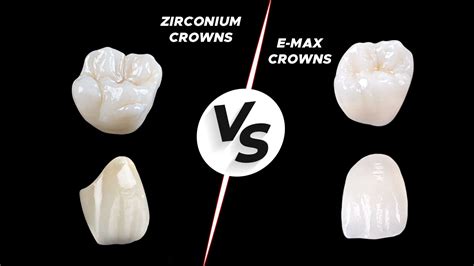Zirconia Crown Lab Procedure at Declan Thwaites blog