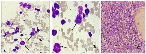 IJPO - Indian J Pathol Oncol