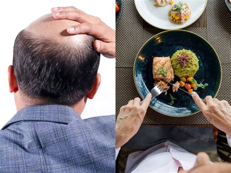 Facing hair loss? The reason might be hiding in your plate; so don't ...