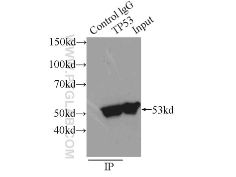 P53 antibody (21891-1-AP) | Proteintech