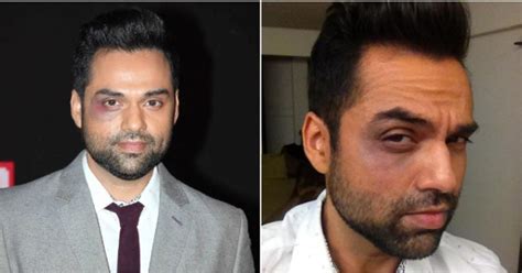 Abhay Deol Once Walked The Red Carpet Of An Event With A Black Eye In ...