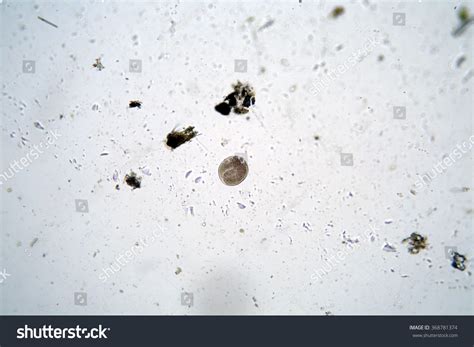 Microscopic Single Cell Animals Found Fresh Stock Photo 368781374 ...