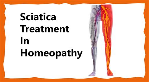 Best Treatment For Sciatica | Sciatic Treatment In Homeopathy ...