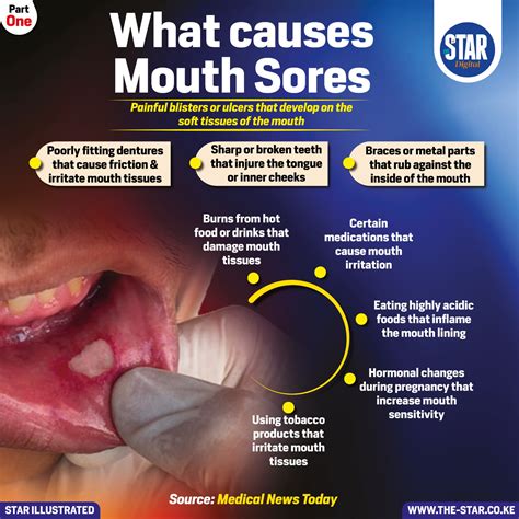 What causes mouth sores