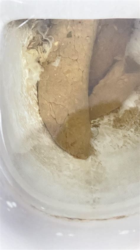 Is this flat stool? And is it serious or normal?? What ia this black spot??? : r/poop