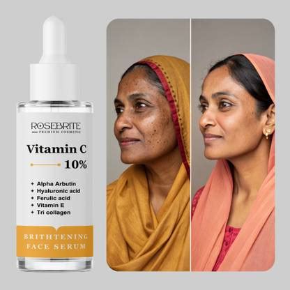 RoseBrite Best Vitamin C 10% Serum for Hyperpigmentation – Alpha ...
