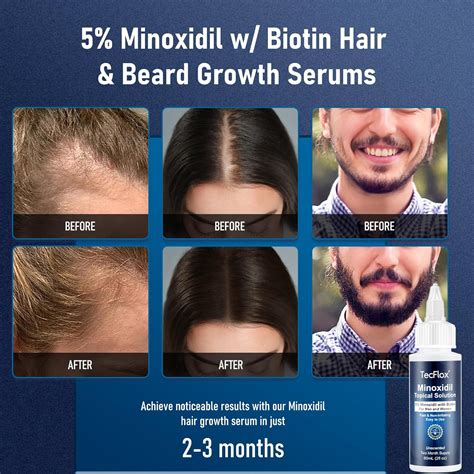 TECFLOX 5% Minoxidil for Men Hair with Biotin, Minoxidil for India | Ubuy