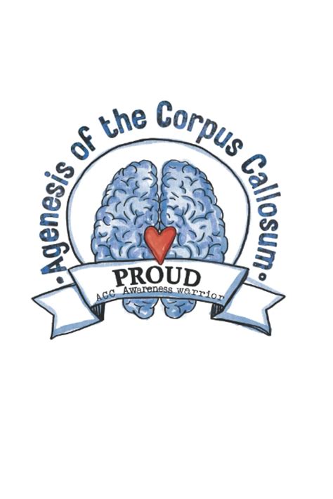 Buy Agenesis of the Corpus Callosum (ACC) Medical Journal: Agenesis of ...