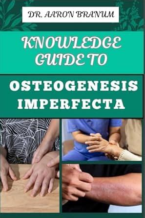 Buy Knowledge Guide to Osteogenesis Imperfecta: Essential Manual To ...