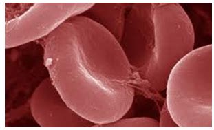 Figure 6: Red blood cell.