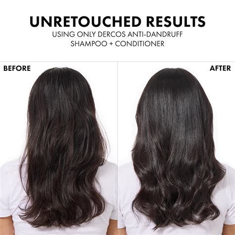 Dercos Selenium Sulfide Anti Dandruff Shampoo, Dry India | Ubuy